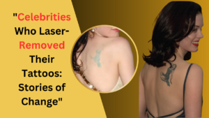 "Celebrities Who Laser-Removed Their Tattoos: Stories of Change"