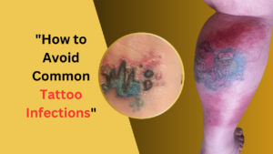 How to Avoid Common Tattoo Infections