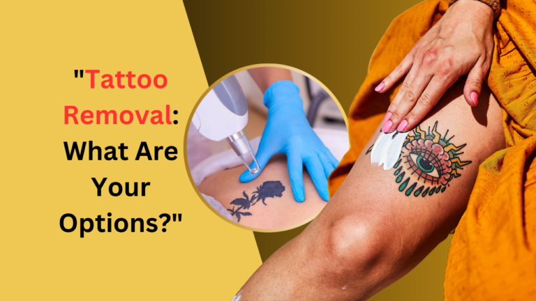 Tattoo Removal: What Are Your Options?